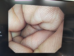 上部消化管汎用ビデオスコープ｜GIF-H290｜オリンパスメディカルシステムズ株式会社の写真6枚目