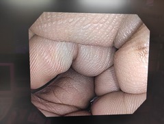 大腸ビデオスコープ｜PCF-Q150AI｜オリンパスメディカルシステムズ株式会社の写真6枚目