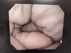 上部消化管汎用ビデオスコープ｜GIF-Q150X｜オリンパスメディカルシステムズ株式会社の写真6枚目