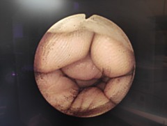 Fiber Gastroscope｜GIF-XQ40｜Olympus Medical Systems photo6