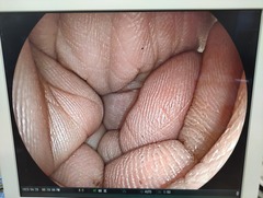 上部消化管用経鼻スコープ｜EG-580NW｜富士フイルムメディカルの写真6枚目