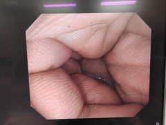大腸ビデオスコープ｜PCF-PQ260I｜オリンパスメディカルシステムズ株式会社の写真6枚目