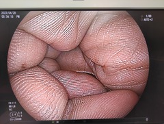 上部消化管用経鼻スコープ｜EG-L580NW｜富士フイルムメディカルの写真6枚目