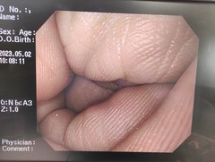 Video Gastroscope｜GIF-Q260｜Olympus Medical Systems photo6