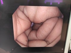 大腸ビデオスコープ｜PCF-H290ZI｜オリンパスメディカルシステムズ株式会社の写真6枚目