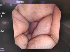 上部消化管汎用ビデオスコープ(径鼻対応)｜GIF-XP260N｜オリンパスメディカルシステムズ株式会社の写真6枚目