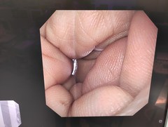 上部消化管汎用ビデオスコープ｜GIF-XQ260｜オリンパスメディカルシステムズ株式会社の写真6枚目