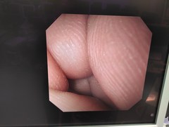 Video Gastroscope｜GIF-XK200｜Olympus Medical Systems photo6