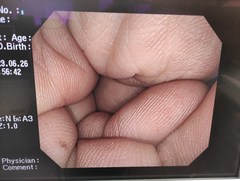 大腸ビデオスコープ｜CF-Q240I｜オリンパスメディカルシステムズ株式会社の写真6枚目
