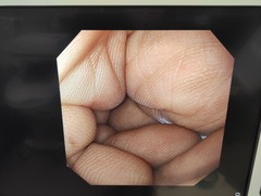 上部消化管汎用ビデオスコープ｜GIF-XP290N｜オリンパスメディカルシステムズ株式会社の写真6枚目