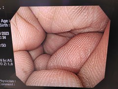 上部消化管汎用ビデオスコープ｜GIF-Q260｜オリンパスメディカルシステムズ株式会社の写真6枚目