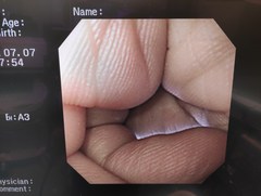 上部消化管汎用ビデオスコープ｜GIF-XQ260｜オリンパスメディカルシステムズ株式会社の写真6枚目