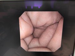 上部消化管経鼻スコープ｜GIF-XP170N｜オリンパスメディカルシステムズ株式会社の写真6枚目