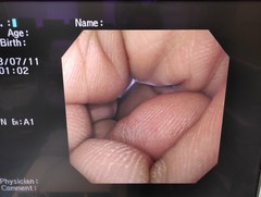 上部消化管汎用ビデオスコープ｜GIF-XQ260｜オリンパスメディカルシステムズ株式会社の写真6枚目