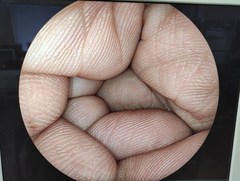 Video Colonoscope｜EC-590MP｜Fujifilm Medical photo6