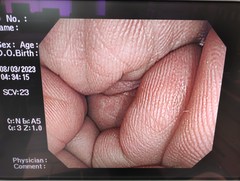 大腸ビデオスコープ｜CF-Q260AI｜オリンパスメディカルシステムズ株式会社の写真6枚目