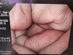 上部消化管汎用ビデオスコープ｜GIF-Q260｜オリンパスメディカルシステムズ株式会社の写真6枚目