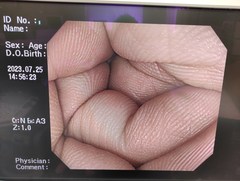 大腸ビデオスコープ｜CF-H260AZI｜オリンパスメディカルシステムズ株式会社の写真6枚目