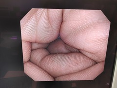 大腸ビデオスコープ｜PCF-Q260AZI｜オリンパスメディカルシステムズ株式会社の写真6枚目