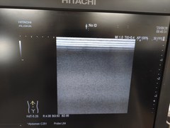 Ultrasound system｜ARIETTA 60｜Hitachi photo6