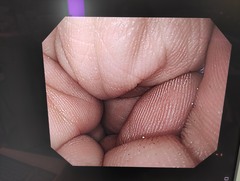 上部消化管汎用ビデオスコープ｜GIF-Q260｜オリンパスメディカルシステムズ株式会社の写真6枚目