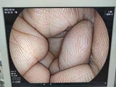 上部消化管用経鼻スコープ｜EG-L580NW7｜富士フイルムメディカルの写真6枚目
