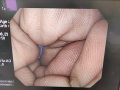 上部消化管汎用ビデオスコープ｜GIF-Q260｜オリンパスメディカルシステムズ株式会社の写真6枚目