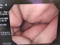 上部消化管汎用ビデオスコープ｜GIF-Q260｜オリンパスメディカルシステムズ株式会社の写真6枚目