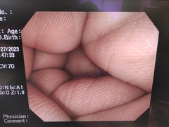 大腸ビデオスコープ｜CF-Q260AI｜オリンパスメディカルシステムズ株式会社の写真6枚目