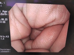 上部消化管汎用ビデオスコープ｜GIF-Q260｜オリンパスメディカルシステムズ株式会社の写真6枚目