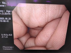 上部消化管汎用ビデオスコープ｜GIF-Q260｜オリンパスメディカルシステムズ株式会社の写真6枚目