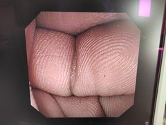 Video Duodenoscope｜JF-260V｜Olympus Medical Systems photo6