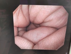 上部消化管汎用ビデオスコープ｜GIF-Q260｜オリンパスメディカルシステムズ株式会社の写真6枚目
