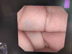 Video Duodenoscope｜JF-240｜Olympus Medical Systems photo6