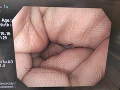 上部消化管汎用ビデオスコープ｜GIF-Q240X｜オリンパスメディカルシステムズ株式会社の写真6枚目