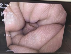 上部消化管汎用ビデオスコープ｜GIF-Q150X｜オリンパスメディカルシステムズ株式会社の写真6枚目