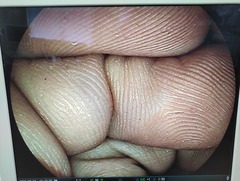 Video Duodenoscope｜ED-450XL8｜Fujifilm Medical photo6