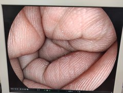 上部消化管ビデオスコープ｜EG-590WR｜富士フイルムメディカルの写真6枚目