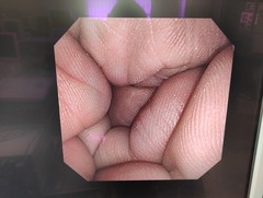 上部消化管汎用細経ビデオスコープ｜GIF-XP260｜オリンパスメディカルシステムズ株式会社の写真6枚目