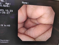 上部消化管汎用ビデオスコープ｜GIF-XP260NS｜オリンパスメディカルシステムズ株式会社の写真6枚目