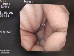 Video Gastroscope｜GIF-XQ260｜Olympus Medical Systems photo6