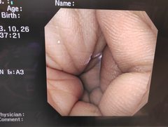 上部消化管汎用ビデオスコープ｜GIF-XQ260｜オリンパスメディカルシステムズ株式会社の写真6枚目