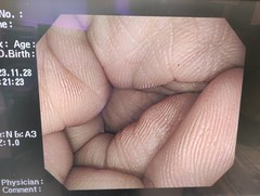大腸ビデオスコープ｜CF-Q260AI｜オリンパスメディカルシステムズ株式会社の写真6枚目