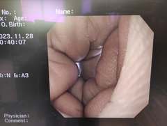 上部消化管汎用ビデオスコープ｜GIF-XQ260｜オリンパスメディカルシステムズ株式会社の写真6枚目