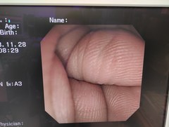 Video Duodenoscope｜JF-240｜Olympus Medical Systems photo6