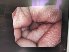 上部消化管汎用ビデオスコープ｜GIF-H290｜オリンパスメディカルシステムズ株式会社の写真6枚目