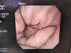 Video Gastroscope｜GIF-XP260NS｜Olympus Medical Systems photo6