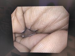 上部消化管汎用ビデオスコープ｜GIF-Q150X｜オリンパスメディカルシステムズ株式会社の写真6枚目