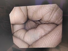 上部消化管汎用ビデオスコープ｜GIF-H170｜オリンパスメディカルシステムズ株式会社の写真6枚目