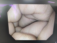 上部消化管汎用ビデオスコープ｜GIF-H190N｜オリンパスメディカルシステムズ株式会社の写真6枚目